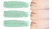 Load image into Gallery viewer, EcoFeminii Targeted Spot & Blemish Repair Acne Sticker Patches-108 Count/3 Sheets-Absorbing Hydrocolloid Dots-Effective on Oily & Combination Skin-Transparent Remedy for Pimples & Whiteheads