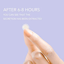 Load image into Gallery viewer, Acne Patches Aliobio Hydrocolloid Patches Pimple Patches Spot Patches Invisible Acne Stickers (6 sheet/216 Patches)