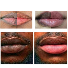 Load image into Gallery viewer, Ombhsd Removes Lips Dark Cream Pink Balm Bleaching Fresh Fast Treatment Lips Lip Butters (black, One Size)