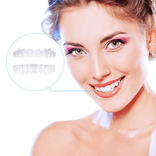 Load image into Gallery viewer, teeth veneers uk