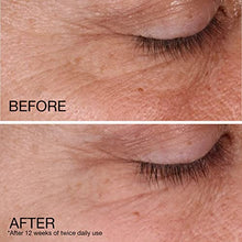 Load image into Gallery viewer, Neutrogena Rapid Wrinkle Repair Retinol Anti-Wrinkle Regenerating Face Cream, Day and Night Use, 1.7 oz