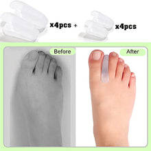 Load image into Gallery viewer, Flared Gel Toe Separators DYKOOK 8 Pieces Big Small Toe Spacers Toe Straighteners for Overlapping Toes and Temporary Bunion Corrector Gel (4 pcs Large + 4 pcs Small)