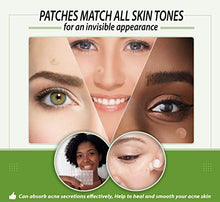 Load image into Gallery viewer, Spot Pimple Patches Hydrocolloid Salicylic Acid Cleanses Pimples Invisible Spot Dots Suitable for Acne Prone Skin (36 Dots)