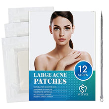 Load image into Gallery viewer, MEEYEE Large Acne Pimple Patch, Spot Treatment, Acne Dots, Pimple Stickers, 6 packs -12 Strips