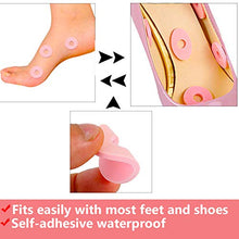 Load image into Gallery viewer, bunions and corns