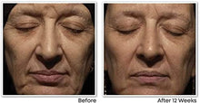 Load image into Gallery viewer, RoC - Retinol Correxion Wrinkle Correct Night Cream - Anti-Wrinkle and Ageing - Face Moisturiser - With Retinol, Shea Butter, Glycolic Acid and Squalane - 30 ml