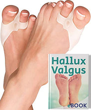 Load image into Gallery viewer, Bunion Corrector Toe Separators (6Pcs, Transparent, 0% BPA) - Hallux Valgus Soft Silicone Pads, Bunion Support, Splint for Overlapping Toes Straightener