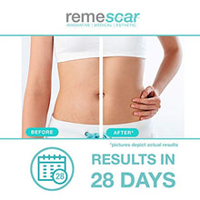 Load image into Gallery viewer, Remescar - Stretch Marks Treatment - Cream for Stretch Mark Scars - Clinically Proven Stretch Mark Prevention