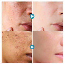Load image into Gallery viewer, Instant Perfection Wrinkles Essence Serum,Soften Anti-Aging Wrinkle Skin Facial Serum2PC