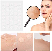 Load image into Gallery viewer, Acne Pimple Master Patches Spot & Blemish Treatment Stickers Invisible Hydrocolloid Patches (216P)