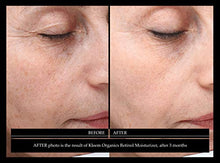 Load image into Gallery viewer, Retinol Face Cream with Hyaluronic Acid & Vitamin E - The Best Anti Aging Cream to Reduce Wrinkles & Age Spots Day & Night use Better than any Anti Wrinkle Retinol Serum & Moisturizer Face Women