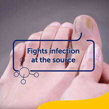Load image into Gallery viewer, Scholl Fungal Nail Treatment, 3.8 ml