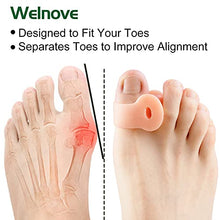 Load image into Gallery viewer, Welnove Gel Toe Separators, 8 Pack Toe Spacers(Large and Medium), Bunions And Overlap Toe Corrector for Women And Men, Toe Spreader for Reducing Pressure -Salmon