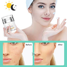 Load image into Gallery viewer, Acne Treatment Cream Ivnil Anti Acne Spot Treatment For Face, Back, Inner Thigh Butt, Anti Acne Cream For Teenagers Suitable For Sensitive Skin Natural Ingredients 30ml