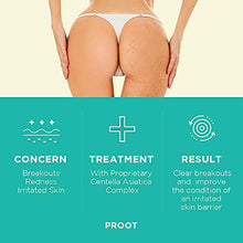 Load image into Gallery viewer, Butt Acne Clearing Spot Treatment Cream. Clears Acne, Pimples, Ingrown Hairs, Blackheads, Zits, Razor Bumps and Dark Spots for the Buttocks and Thigh Area. Prevents Future Breakouts.