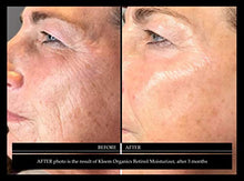 Load image into Gallery viewer, Retinol Face Cream with Hyaluronic Acid & Vitamin E - The Best Anti Aging Cream to Reduce Wrinkles & Age Spots Day & Night use Better than any Anti Wrinkle Retinol Serum & Moisturizer Face Women