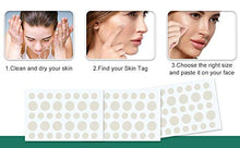 Load image into Gallery viewer, Acne Pimple Master Patches Spot & Blemish Treatment Stickers Invisible Hydrocolloid Patches (216P)