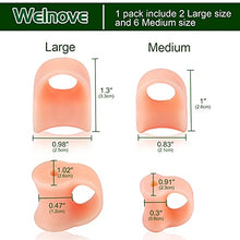 Load image into Gallery viewer, Welnove Gel Toe Separators, 8 Pack Toe Spacers(Large and Medium), Bunions And Overlap Toe Corrector for Women And Men, Toe Spreader for Reducing Pressure -Salmon