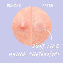 Load image into Gallery viewer, Acne Patches Aliobio Hydrocolloid Patches Pimple Patches Spot Patches Invisible Acne Stickers (6 sheet/216 Patches)