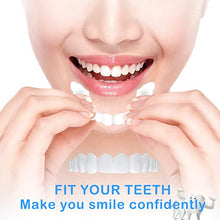Load image into Gallery viewer, teeth veneers uk
