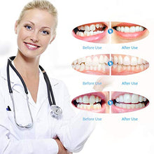 Load image into Gallery viewer, teeth aligners uk