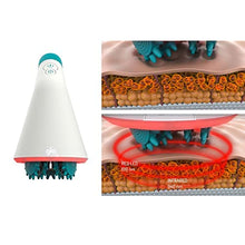 Load image into Gallery viewer, Glo910+ Anti Cellulite Massage Machine with 4 Massage Heads | Ultimate Tool for Toning Legs, Butt, Thighs and Tired Heavy Muscles | Perfect for Body Scrub or Exfoliation Session