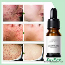 Load image into Gallery viewer, Instant Perfection Wrinkles Essence Serum,Soften Anti-Aging Wrinkle Skin Facial Serum2PC