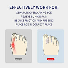 Load image into Gallery viewer, Zinyakon Silicone Toe Separators, 12 Packs of Gel Toe Spacers for Men and Women, Bunion Corrector for Bunion, Overlapping Toes, Crooked Toes, Hammer Toe