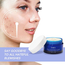 Load image into Gallery viewer, Acne Treatment Cream Lopsx Spot Treatment for Spots Blemishes Problem Skin Double Strength Suitable and Safe for Prone to Acne Skin & Sensitive Skin
