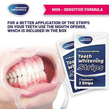 Load image into Gallery viewer, Teeth Whitening Strips - Non-Sensitive Formula - 20 Whitening Sessions - Safe for Enamel - 40 Peroxide Free Whitening Strips with Mouth Opener Included