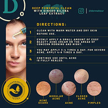 Load image into Gallery viewer, POWERFUL Anti Acne Removal Cream by DermaHour. Formula for Pimples, Spot, Skin Tag, and Ingrown Hair. Balance Water And Oil. Skincare Moisturiser. Ginkgo Biloba Extract. (40ml)
