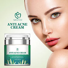 Load image into Gallery viewer, Anti Acne Treatments Cream, Acne Scar Removal Cream, Acne Face Cream, Anti Pimple Cream for Oily Combination or Sensitive Skin of All Ages for All Genders