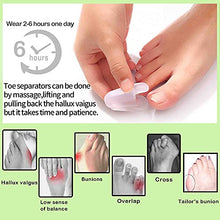Load image into Gallery viewer, Flared Gel Toe Separators DYKOOK 8 Pieces Big Small Toe Spacers Toe Straighteners for Overlapping Toes and Temporary Bunion Corrector Gel (4 pcs Large + 4 pcs Small)