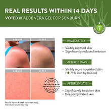 Load image into Gallery viewer, ๐๐ฎ๐ซ๐ Aloe Vera Gel for Face, Hair & Body - 100% Natural Organic Aloe Vera Gel for After Sun Skin Care, Soothing, Hydrating - Hand Harvested & Cold Pressed in Australia - Dermatologist Developed
