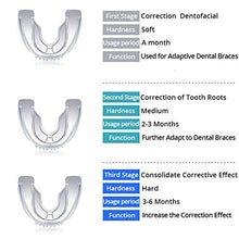 Load image into Gallery viewer, teeth aligners uk