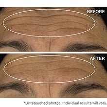 Load image into Gallery viewer, StriVectin Wrinkle Recode Line Transforming Melting Serum