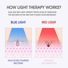 Load image into Gallery viewer, Hangsun Light Therapy Mask Anti Acne Unlimited Sessions for Face Skin Care FT330-2 in 1 Works for 10 Mins Daily