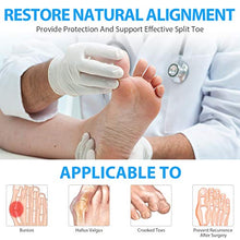 Load image into Gallery viewer, Adepoy Bunion Corrector,Orthopedic Bunion Correctors,Big Toe Separator Pain Relief,for Overlapping Toes,Hallux Valgus Correction,Hammer Toe Straightener,Day Night Support