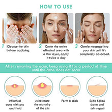 Load image into Gallery viewer, Acne Treatment Cream Ivnil Anti Acne Spot Treatment For Face, Back, Inner Thigh Butt, Anti Acne Cream For Teenagers Suitable For Sensitive Skin Natural Ingredients 30ml