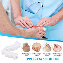 Load image into Gallery viewer, Toe Separators for Overlapping Toes, Gel Toe Straightener Bunion Corrector, Toe Spacers for Hallux Valgus, Crooked Toes Yogis Dancers or Runners