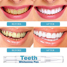 Load image into Gallery viewer, Teeth Whitening Pen,Teeth Whitening Gel,Teeth Whitening Kit,Whitening Gel Pen,Removes Stain,Give You a Beautiful Smile