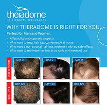 Load image into Gallery viewer, Theradome PRO LH80 Laser Helmet for Hair Loss Treatments in Men and Women. (LH80 PRO), White