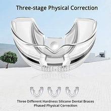 Load image into Gallery viewer, teeth aligners uk