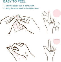 Load image into Gallery viewer, Acne Pimple Patches Acne Spot Treatments Hydrocolloid Patches Invisible Spot & Blemish Acne Stickers 144 Patches