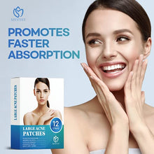 Load image into Gallery viewer, MEEYEE Large Acne Pimple Patch, Spot Treatment, Acne Dots, Pimple Stickers, 6 packs -12 Strips