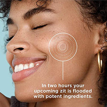 Load image into Gallery viewer, ZitSticka Killa Kit | Self-Dissolving Microdart Acne Pimple Patch for Zits and Blemishes, Spot Treatment Stickers for Face and Skin, Vegan and Cruelty Free (8 Pack)