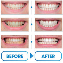 Load image into Gallery viewer, TEBRIGHT Teeth Whitening Kit - Stains and Plaques Bleaching Remove– Bright Teeth & Smile with Teeth Whitener - Whitening LED Light Pen for Sensitive Teeth