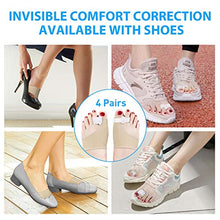 Load image into Gallery viewer, Adepoy Bunion Corrector,Orthopedic Bunion Correctors,Big Toe Separator Pain Relief,for Overlapping Toes,Hallux Valgus Correction,Hammer Toe Straightener,Day Night Support