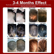 Load image into Gallery viewer, Laser Hair Growth Therapy Cap (LLLT),108 Lasers for Hair Loss Treatment for Men and Women,Stimulate Hair Growth, Regrow, Add Density, Get Thicker, Fuller Hair (Black)