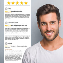 Load image into Gallery viewer, mysmile Activated Charcoal Teeth Whitening Kit - 6X Teeth Whitening Gel, LED Teeth Light & Gum Tray Mould - Safe & Easy Home Tooth Whitening - Natural Teeth Whitening Gel - Instant Stain Remover